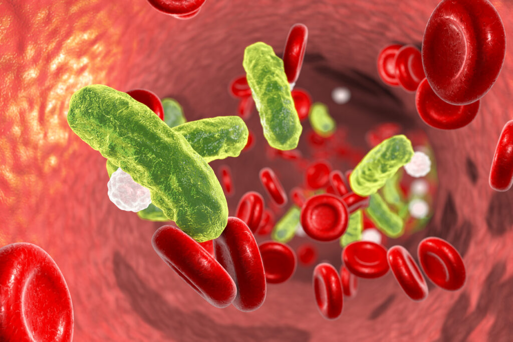 Sepsis,
  bakterier i blodet, nyckelfaktor vid antibiotikaval inom infektionsbehandling